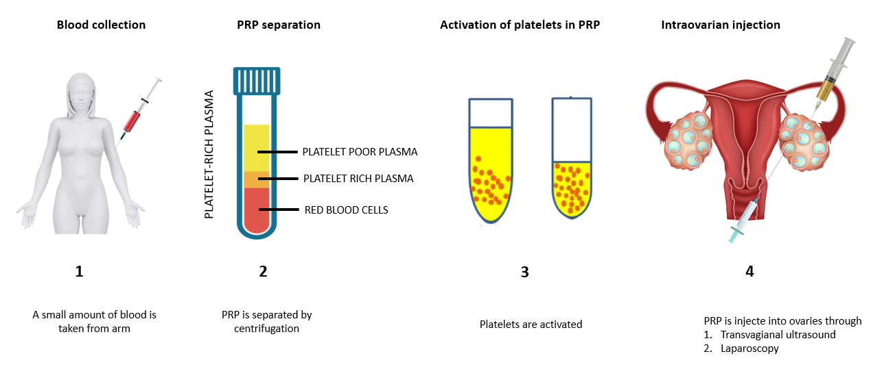 Vaginal PRP Treatment